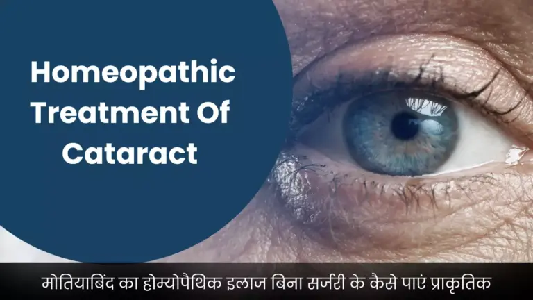 Homeopathic Treatment Of Cataract