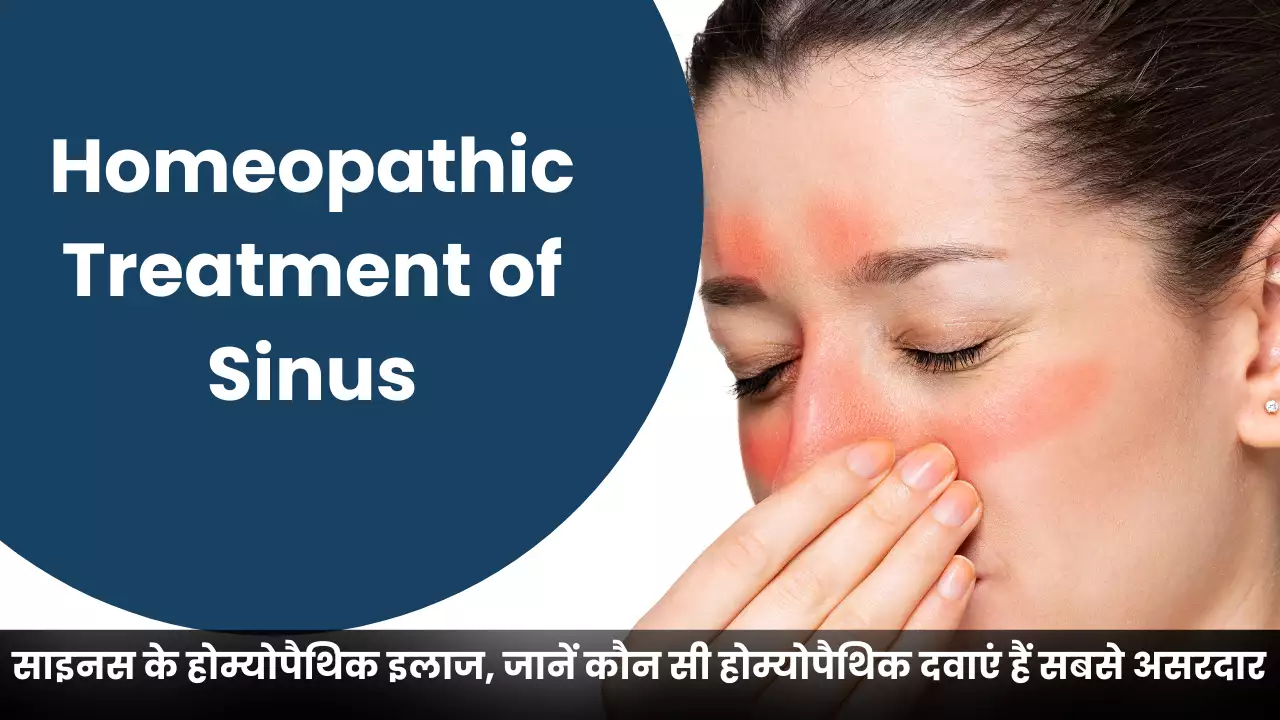 Homeopathic Treatment of Sinus